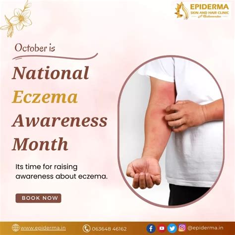 Ppt October Is National Eczema Awareness Month Best Skin Clinic In
