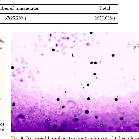 Figure 1 From Cytological Study Of Pleural Cavity Effusions In A