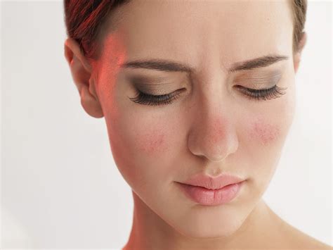 5 Causes Of Red Face And Ways To Reduce It Esmi Skin Minerals