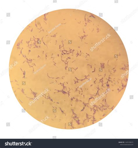 Streptococcus Genus Grampositive Coccus Plural Cocci Stock Photo