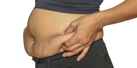 Fifty pounds evenly distributed over someone who is very tall and on the younger side of things might not have any trouble at all with elasticity and the skin may shrink without leaving any looseness, especially if you are also doing. 5 Effective Ways to Get Rid of Loose Skin after Weight Loss