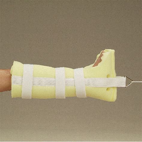 Operative stabilization of femoral shaft fracture. Bucks Traction Boot with Triangle Traction Cord Buckle