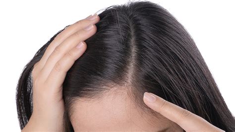 Top 5 Reasons That Cause Hair Thinning In Women Doctor Asky