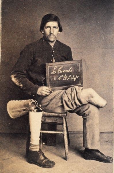 Cdv Of Private L Coombs 4th Us Infantry Seated With His Prosthesis