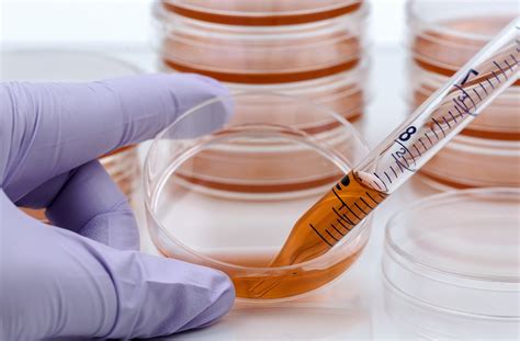 Stem cell therapy may be effective for multiple sclerosis - The ...