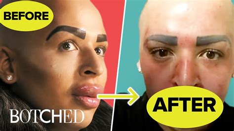 the most insane lips on botched on botched e news canada