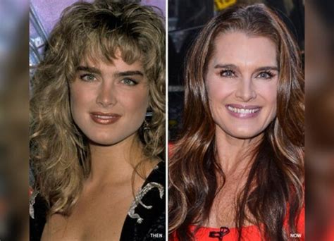 Brooke Shields Plastic Surgery How Does She Deal With The Aging