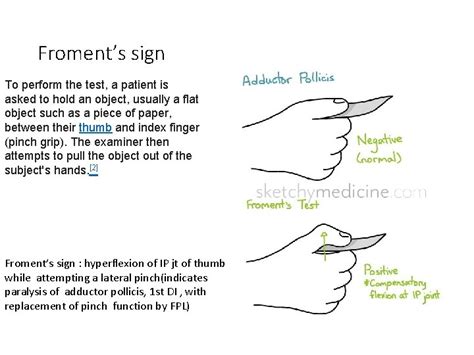 Ulnar Nerve Anatomy Its Lesions Dr Mukesh Singla