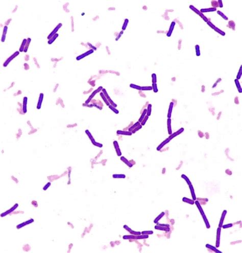 Bacillusdiplobacillus