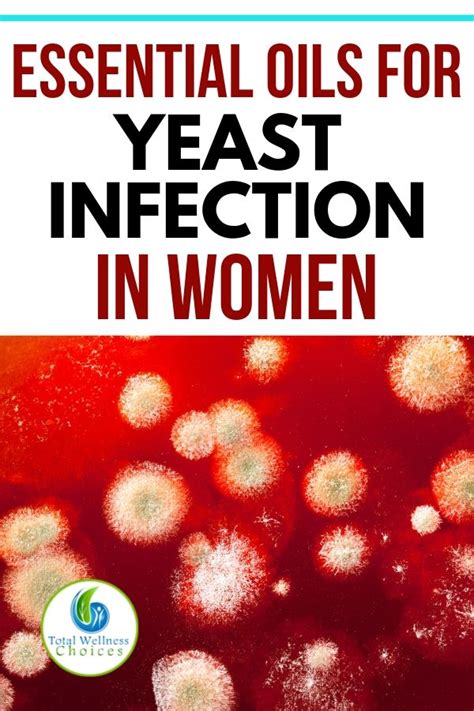 7 Essential Oils For Yeast Infection In Women Yeast Infection Essential Oils Essential Oils