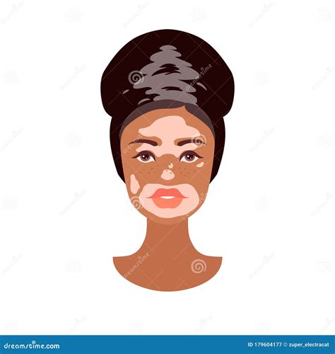 Beautiful Young African Woman Face With Vitiligo Disorder Texture Skin