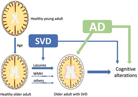 Brain Atrophy In Cerebral Small Vessel Diseases Extent Consequences