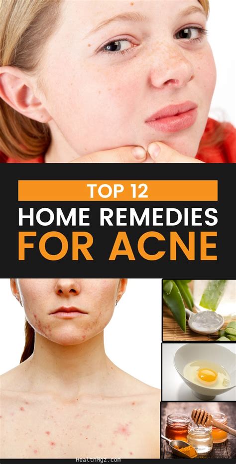 Top 12 Home Remedies To Get Rid Of Chest Acne Fast And Naturally