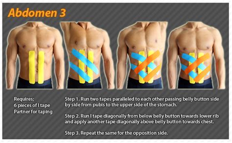 Kinesiology Taping Instructions For The Abdomen Ktape Abdomen Ares