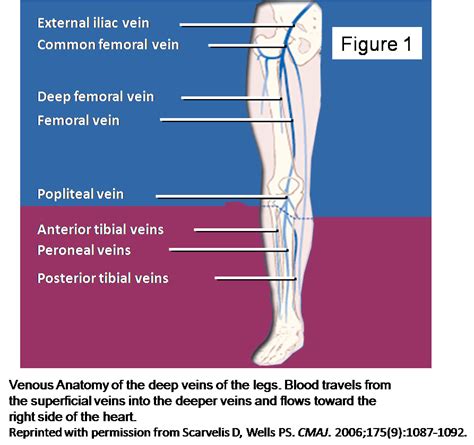 Deep Venous Thrombosis Pictures