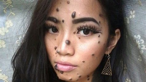 This Miss Universe Malaysia Contestant Was Born With Moles All Over Her