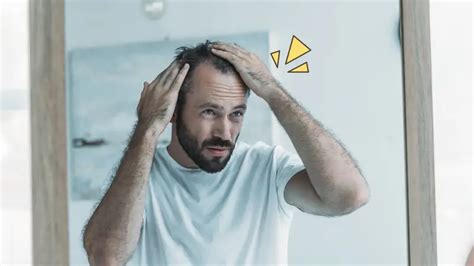 5 Cara Alami Mengatasi Rambut Rontok Pada Pria Orami