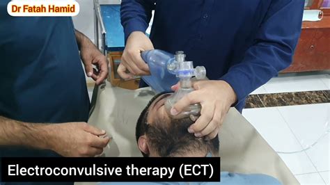 Electroconvulsive Therapy Ect Youtube