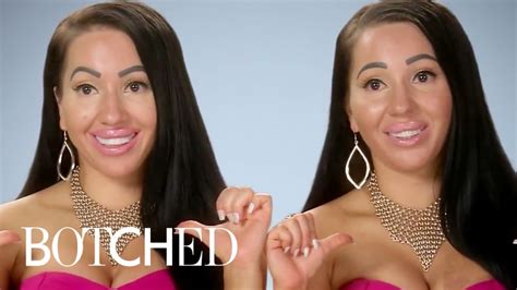 Twins Whove Been On Botched E Youtube
