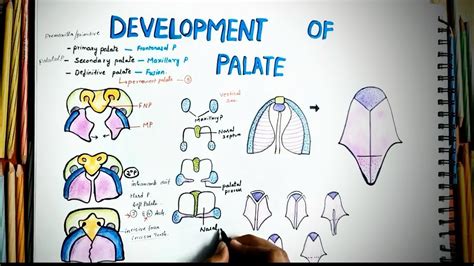 Development Of Palate Embryology Easy Explaination Cleft