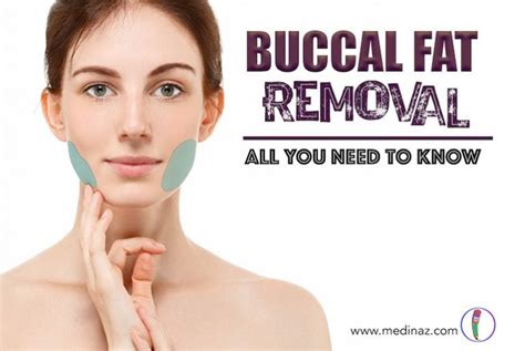 Buccal Fat Removal All You Need To Know