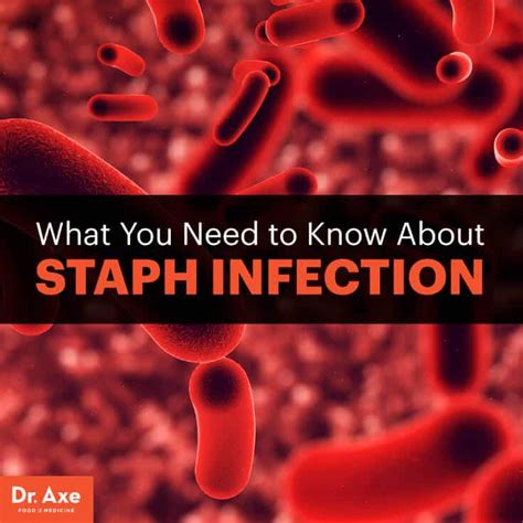 Staph Infection Symptoms Causes And Natural Treatments Best Pure