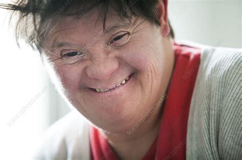 Adult Downs Syndrome Stock Image C0244462 Science Photo Library