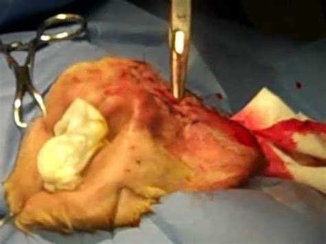Aural hematoma in a cat. Aural Hematoma Sugery - Kind of Graphic - - YouTube