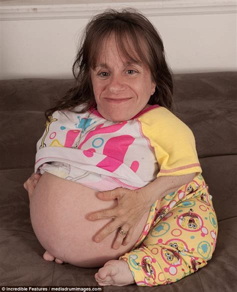 Amazing The Worlds Smallest Mother Suffers From A Rare Genetic Disease Despite The Danger Of