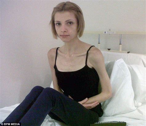 Sian Clarke Who Weighed Below 4st Makes Remarkable Recovery Daily Mail Online