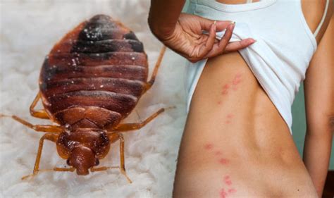 If you want to learn more about how long bed bugs can go. Bed bug bites: Signs you've been bitten and how to get rid ...