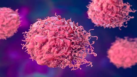 Chinese Researchers Develop Nanoplatform To Kill Cancer Cells