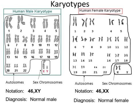 Karyotyping Procedure Uses Examples Protocol Video Results Interpretation