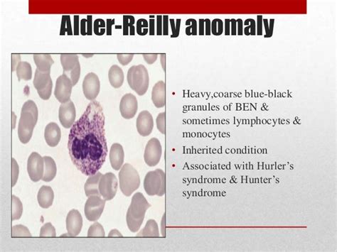 Wbc And Platelets Anomalies