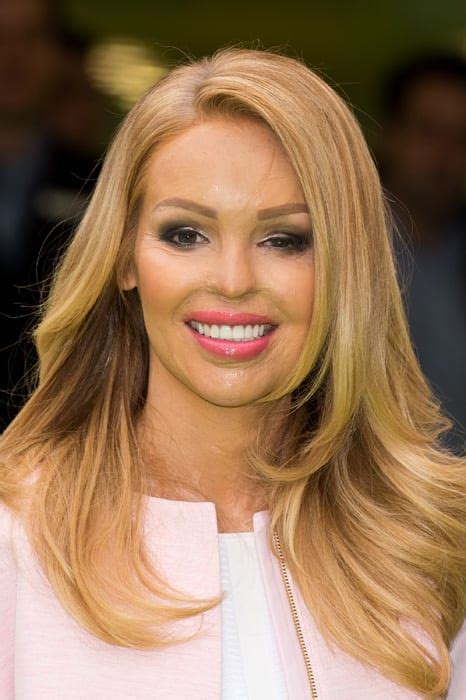 Katie Piper Back In Hospital Following Surgery Complications