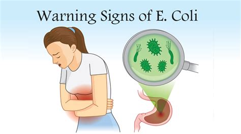 7 Warning Signs It’s Not Just A Stomachache It Could Be E Coli Womenworking
