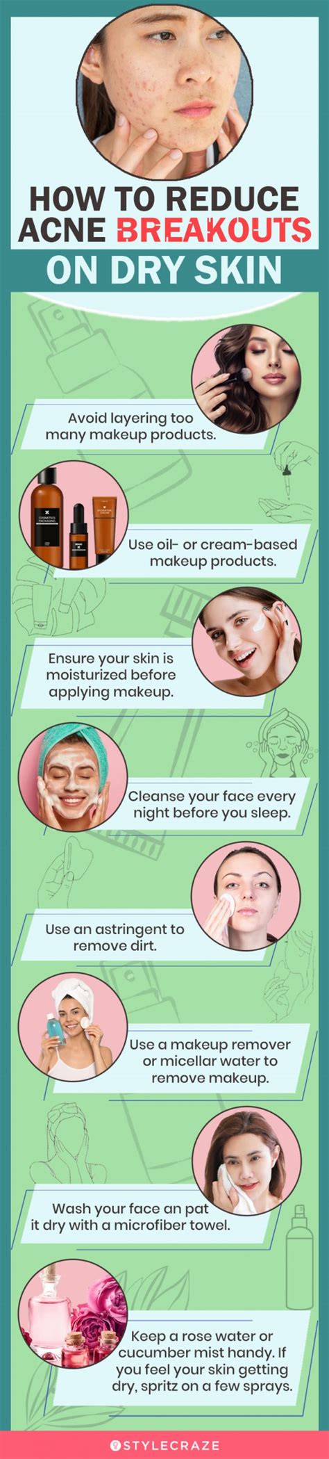 Dry Skin Acne 12 Home Remedies And Tips To Prevent It