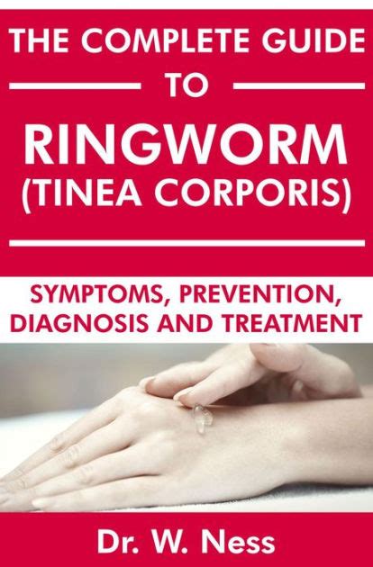 The Complete Guide To Ringworm Tinea Corporis Symptoms Prevention