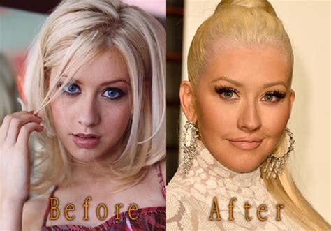 Christina Aguilera Plastic Surgery Before And After Pictures