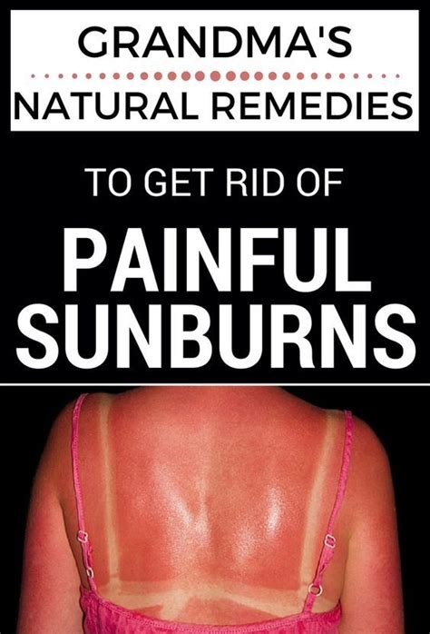 Grandmas Natural Remedies To Get Rid Of Painful Sunburns