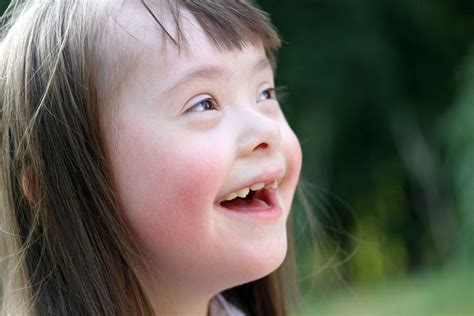 Down Syndrome Brain Disorders And Other General Topics Of The Day