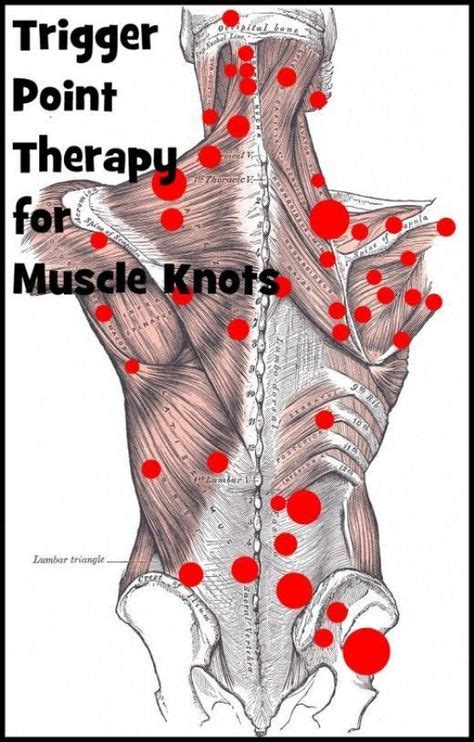 Best 25 Muscle Knots Ideas On Pinterest Trigger Points Neck Trigger