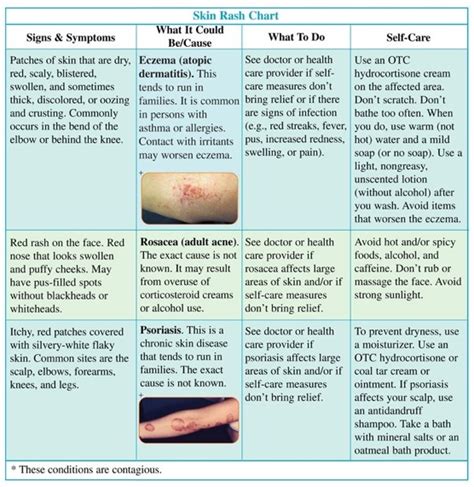 Most Common Types Of Skin Rashes Daily Health Valley Kulturaupice