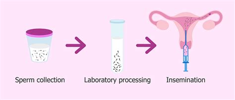 Insemination Pregnant Telegraph