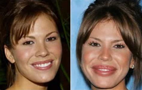 Television Actress Nikki Cox Was Reported To Undergo Cheek And Lip
