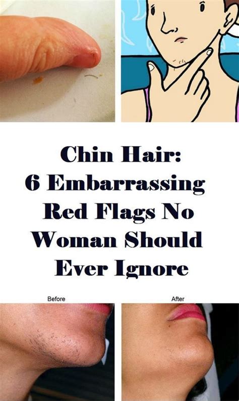 Female Chin Hair What Causes It And What It Could Tell You About Your