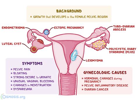 Adnexal Mass What Is It Causes Treatment And More Osmosis