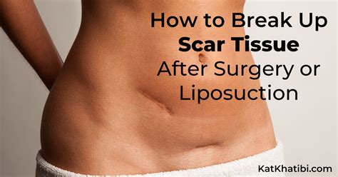 How To Break Up Scar Tissue After Surgery Or Liposuction Healthful Gypsy By Kat Khatibi