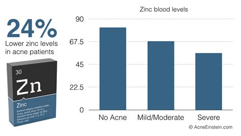 This zinc sulfate is also known to be highly useful for decreasing symptoms of severe acne. Zinc - Acne Einstein