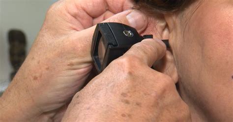 New Guidelines For Treating Tinnitus Or Ringing In The Ears Cbs News